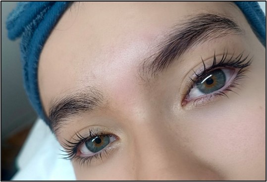 Terapia de relajación